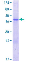 ab163539 on a 12.5% SDS-PAGE stained with Coomassie Blue.