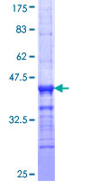 ab163540 on a 12.5% SDS-PAGE stained with Coomassie Blue.