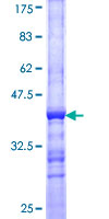 ab159758 on a 12.5% SDS-PAGE stained with Coomassie Blue.