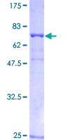 ab159895 on a 12.5% SDS-PAGE stained with Coomassie Blue.