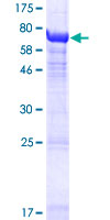 ab164981 on a 12.5% SDS-PAGE stained with Coomassie Blue.