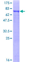 ab164660 on a 12.5% SDS-PAGE stained with Coomassie Blue.