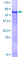 ab162672 on a 12.5% SDS-PAGE stained with Coomassie Blue.