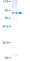 ab160968 on a 12.5% SDS-PAGE stained with Coomassie Blue.