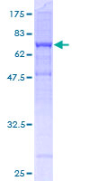 ab160969 on a 12.5% SDS-PAGE stained with Coomassie Blue.
