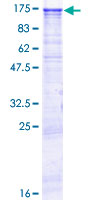 ab165036 on a 12.5% SDS-PAGE stained with Coomassie Blue.