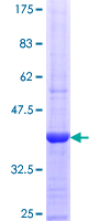 ab165037 on a 12.5% SDS-PAGE stained with Coomassie Blue.