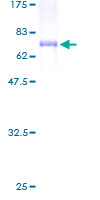 ab159759 on a 12.5% SDS-PAGE stained with Coomassie Blue.