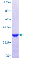 ab159760 on a 12.5% SDS-PAGE stained with Coomassie Blue.