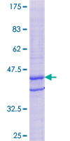 ab164793 on a 12.5% SDS-PAGE stained with Coomassie Blue.