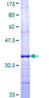 ab161417 on a 12.5% SDS-PAGE stained with Coomassie Blue.
