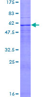 ab159922 on a 12.5% SDS-PAGE stained with Coomassie Blue.