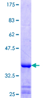 ab153426 on a 12.5% SDS-PAGE stained with Coomassie Blue.