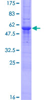 ab164331 on a 12.5% SDS-PAGE stained with Coomassie Blue.