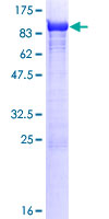ab162505 on a 12.5% SDS-PAGE stained with Coomassie Blue.