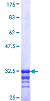 ab162506 on a 12.5% SDS-PAGE stained with Coomassie Blue.
