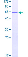 ab161277 on a 12.5% SDS-PAGE stained with Coomassie Blue.