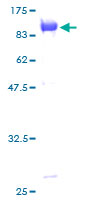 ab153310 on a 12.5% SDS-PAGE stained with Coomassie Blue.