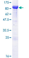 ab162297 on a 12.5% SDS-PAGE stained with Coomassie Blue.
