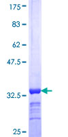 ab162298 on a 12.5% SDS-PAGE stained with Coomassie Blue.