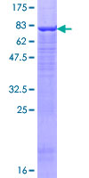 ab161596 on a 12.5% SDS-PAGE stained with Coomassie Blue.