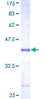 ab161597 on a 12.5% SDS-PAGE stained with Coomassie Blue.