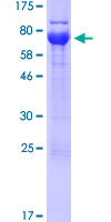 ab164274 on a 12.5% SDS-PAGE stained with Coomassie Blue.