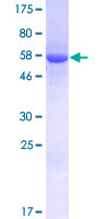 ab161882 on a 12.5% SDS-PAGE stained with Coomassie Blue.