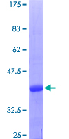 ab162917 on a 12.5% SDS-PAGE stained with Coomassie Blue.