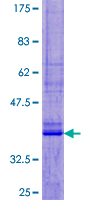 ab164813 on a 12.5% SDS-PAGE stained with Coomassie Blue.
