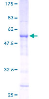 ab160506 on a 12.5% SDS-PAGE stained with Coomassie Blue.