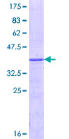 ab162807 on a 12.5% SDS-PAGE stained with Coomassie Blue.