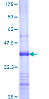 ab162800 on a 12.5% SDS-PAGE stained with Coomassie Blue.