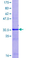 ab159780 on a 12.5% SDS-PAGE stained with Coomassie Blue.