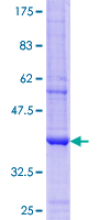 ab159778 on a 12.5% SDS-PAGE stained with Coomassie Blue.