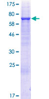 ab165791 on a 12.5% SDS-PAGE stained with Coomassie Blue.