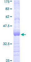 ab153013 on a 12.5% SDS-PAGE stained with Coomassie Blue.