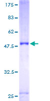 ab153259 on a 12.5% SDS-PAGE stained with Coomassie Blue.