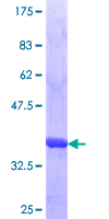 ab153260 on a 12.5% SDS-PAGE stained with Coomassie Blue.