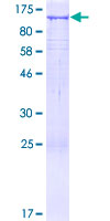 ab163268 on a 12.5% SDS-PAGE stained with Coomassie Blue.
