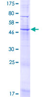 ab161851 on a 12.5% SDS-PAGE stained with Coomassie Blue.