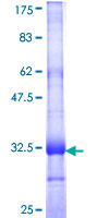 ab164351 on a 12.5% SDS-PAGE stained with Coomassie Blue.