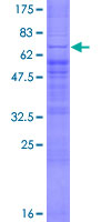ab165177 on a 12.5% SDS-PAGE stained with Coomassie Blue.