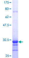 ab165178 on a 12.5% SDS-PAGE stained with Coomassie Blue.