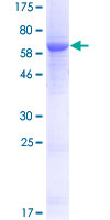 ab162653 on a 12.5% SDS-PAGE stained with Coomassie Blue.