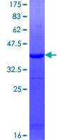 ab162654 on a 12.5% SDS-PAGE stained with Coomassie Blue.