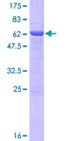 ab165438 on a 12.5% SDS-PAGE stained with Coomassie Blue.