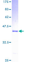 ab159784 on a 12.5% SDS-PAGE stained with Coomassie Blue.