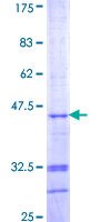 ab159785 on a 12.5% SDS-PAGE stained with Coomassie Blue.