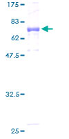 ab159786 on a 12.5% SDS-PAGE stained with Coomassie Blue.
